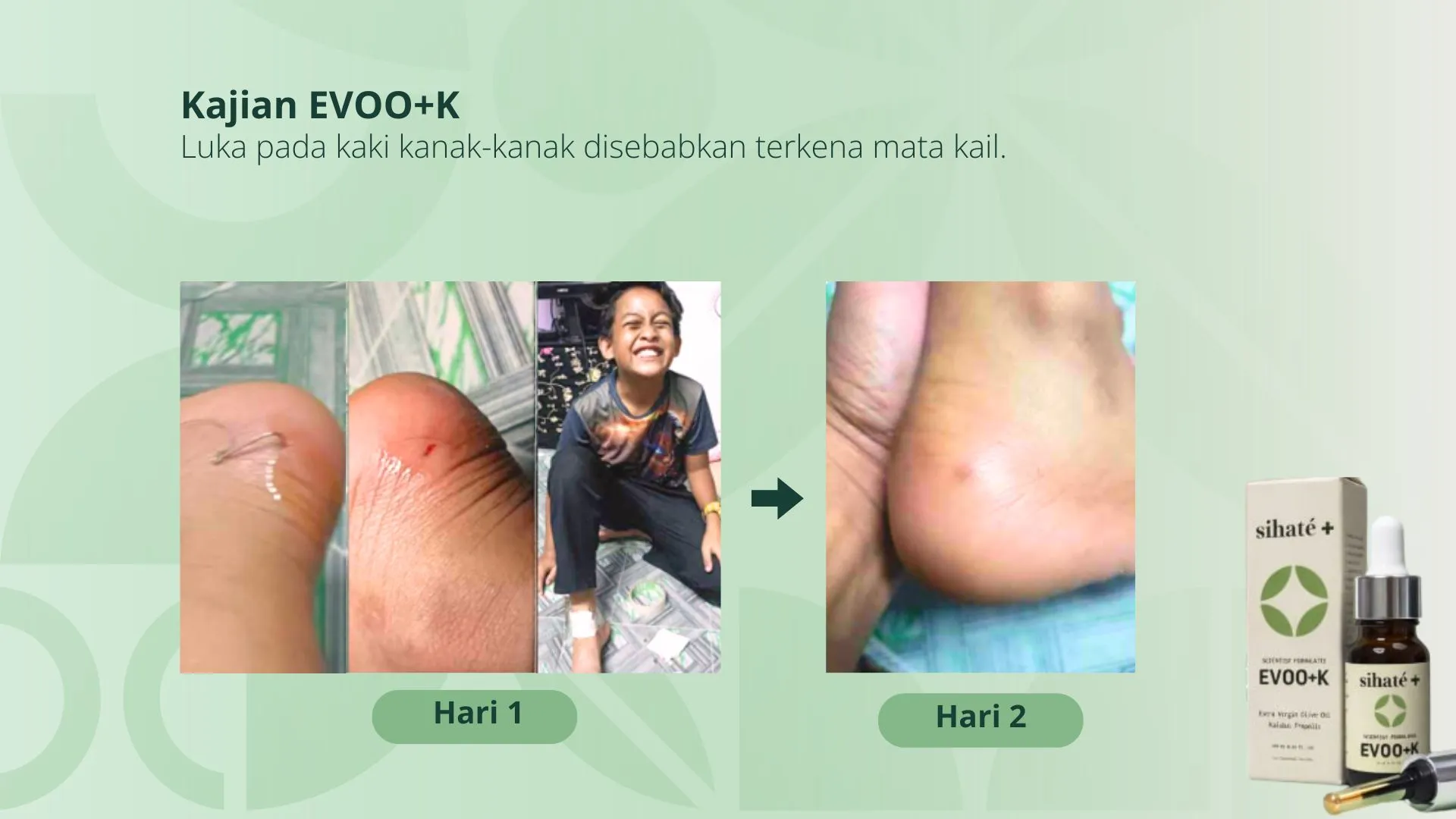 Testimoni Mata Kail